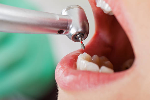 Best Emergency Dental Care for Abscessed Tooth in Vandalia, OH